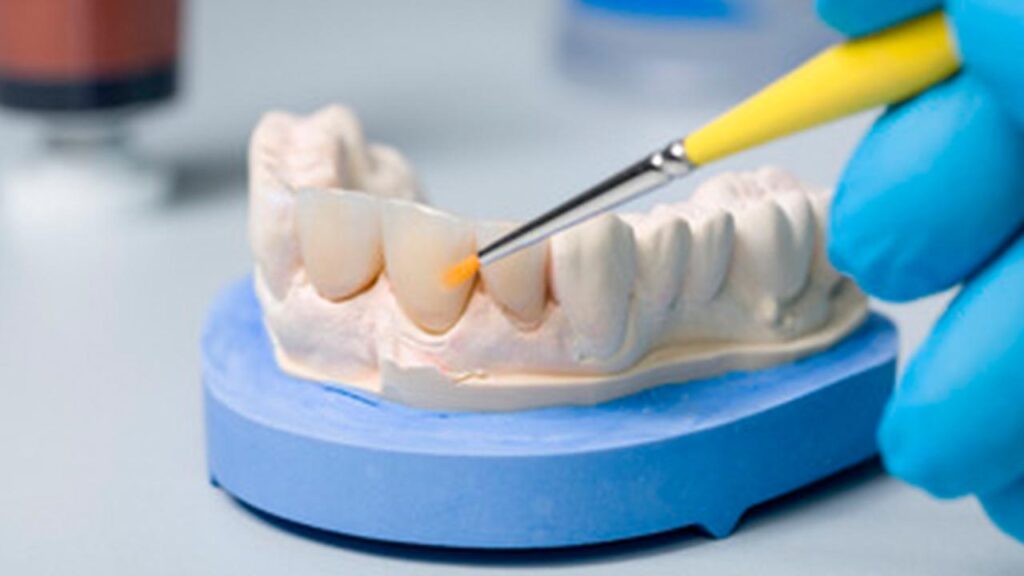 Prótese dente São Leopoldo SorriOrto