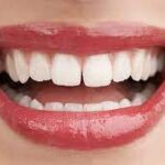 Diastema - Dentista São Leopoldo SorriOrto